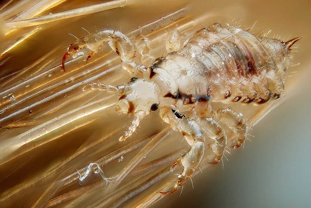 Where Do Head Lice Come From? Deal With Pests